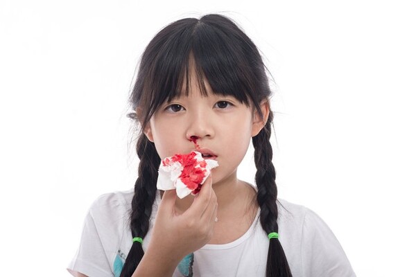 잦은 멍이나 출혈 발생하면, '이 질환' 의심해야 (사진 4)