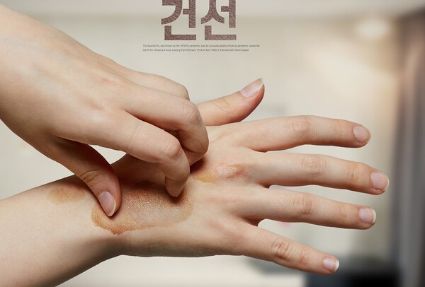 두꺼운 비닐같은 '건선' 증상, 위험한 이유 (+사진주의) (사진 4)