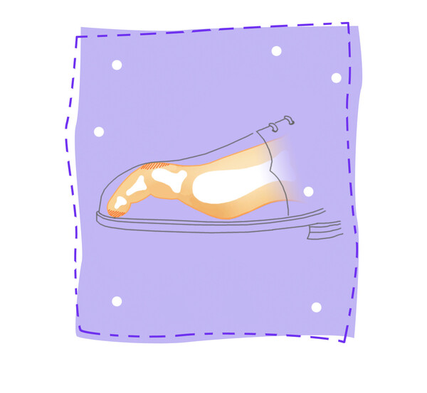 망치족지(제공=힘찬병원)
