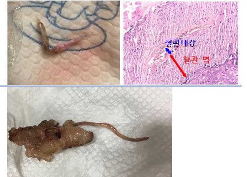 먹어도 되는 축산물 이물질 사례 소개 (사진 2)