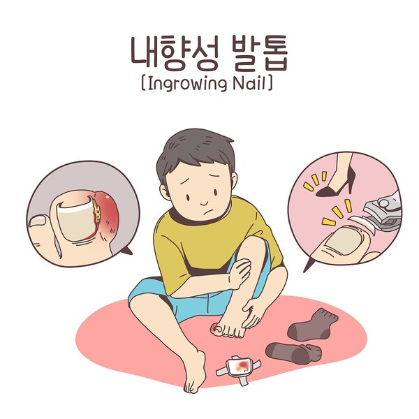 발톱으로 보는 건강 상태 (사진 4)
